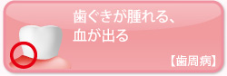 歯ぐきが腫れる、血が出る