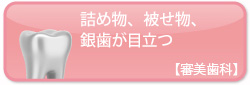 詰め物、被せ物、銀歯が目立つ