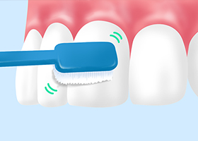 ブラッシング指導